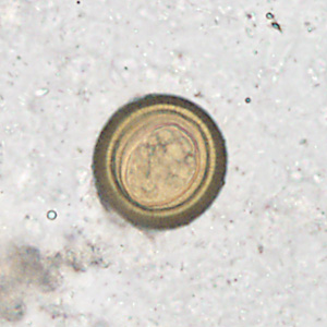 Case358_B.jpg