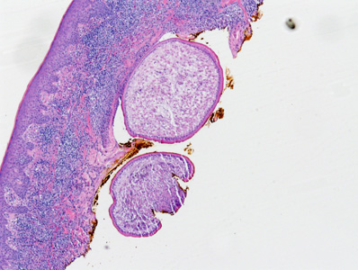 Case387_A.jpg