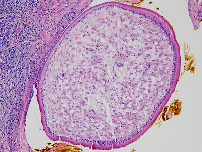 Case387_C.jpg
