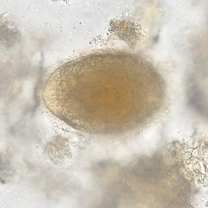 Case388_B.jpg