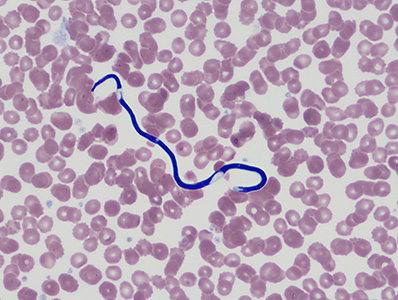 Case390_A.jpg