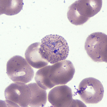 Case392_A.jpg