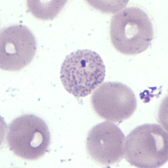 Case392_B.jpg
