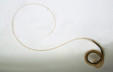 Case393_A.jpg