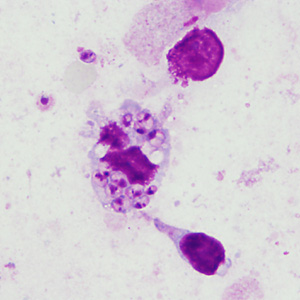 Case394_A.jpg