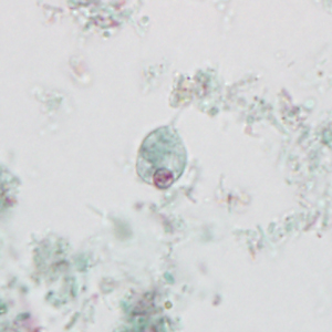 Case395_A.jpg