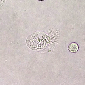Case396_B.jpg