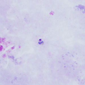 Case398_A.jpg