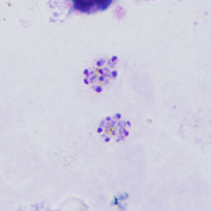 Case398_B.jpg