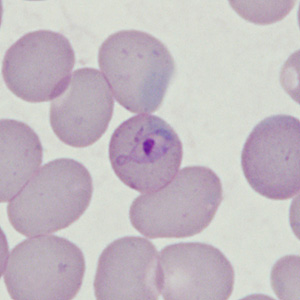 Case398_C.jpg