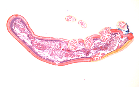 Case399_A.jpg