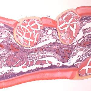 Case399_B.jpg