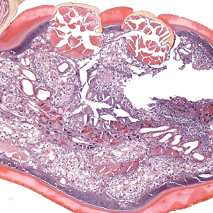 Case399_D.jpg