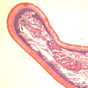 Case399_E.jpg