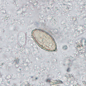Case402_A.jpg