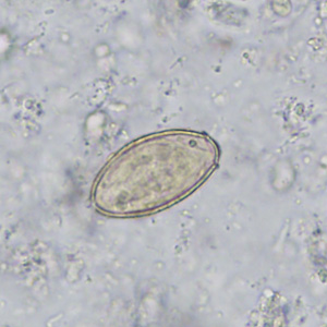 Case402_B.jpg
