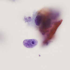 Case405_C.jpg