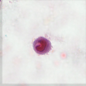 Case406_A.jpg