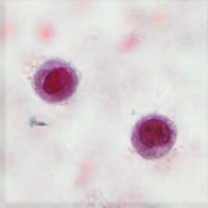 Case406_B.jpg