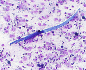 Case407_A.jpg