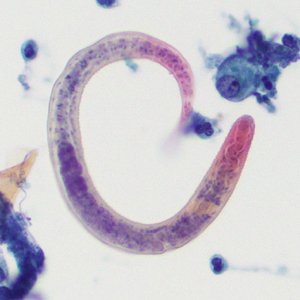 Case407_C.jpg