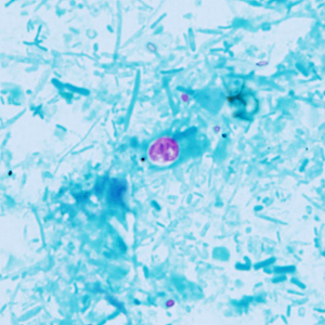 Case409_A.jpg