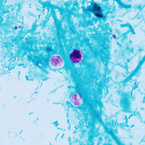 Case409_C.jpg