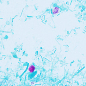 Case409_D.jpg