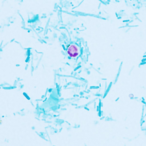 Case409_E.jpg