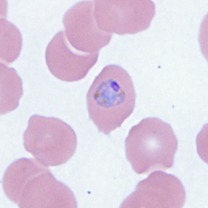 Case410_A.jpg