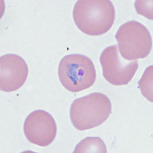 Case410_B.jpg