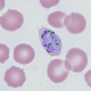 Case410_G.jpg