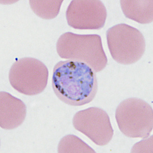 Case410_H.jpg