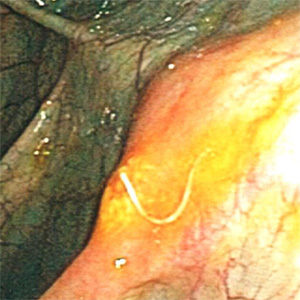 Case411_A.jpg Figure A