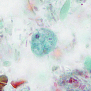Case414_A.jpg