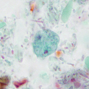 Case414_B.jpg
