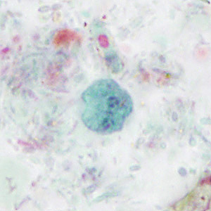 Case414_C.jpg