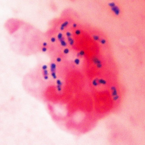 Case415_A.jpg