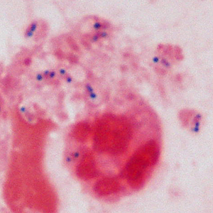 Case415_B.jpg