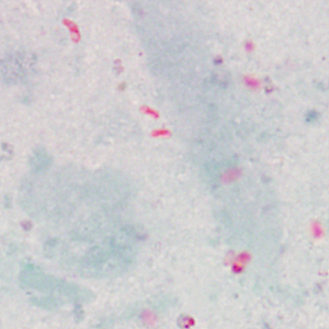 Case415_D.jpg