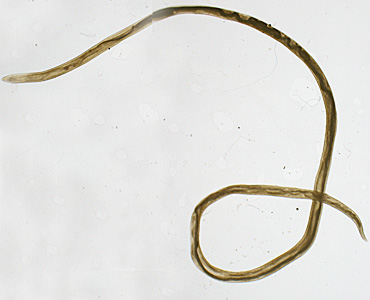 Case417_A.jpg