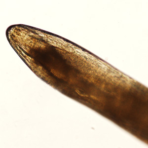 Case417_B.jpg