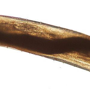 Case417_C.jpg