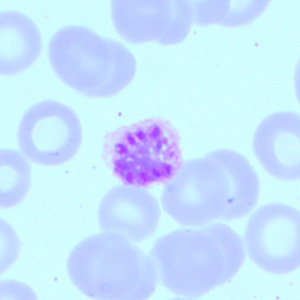 Case418_A.jpg