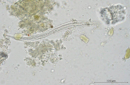 Case421_B.jpg