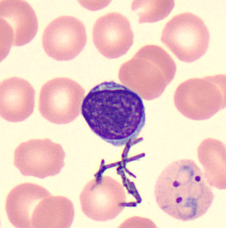 Case424_A.jpg