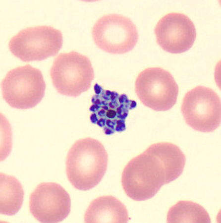 Case424_B.jpg