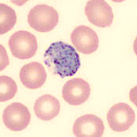 Case424_E.jpg
