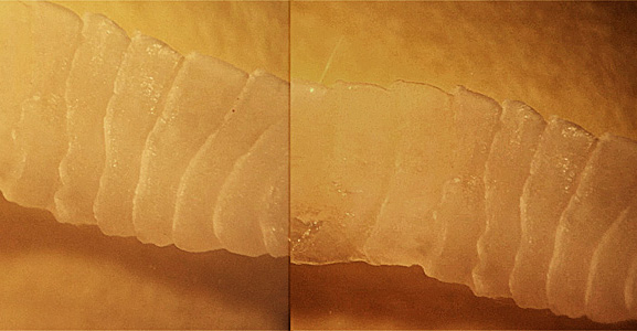 Case425_B.jpg