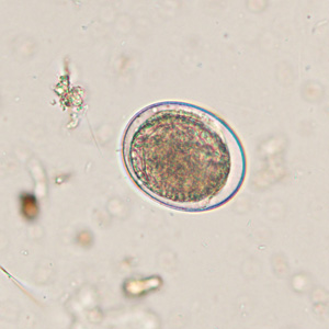 Case425_D.jpg